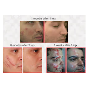 محصول سلول آر کالر (RecolorCell) از شرکت سل تک فارمد