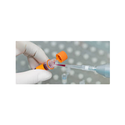 محصول کیت تشخیص هپاتیت بی به روش پی سی آر (HBV PCR Detection Kit) از شرکت تعاونی دانش بنیان زیست رویش