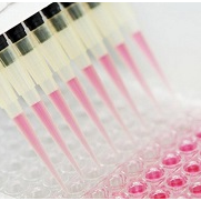 محصول کیت تشخیص ایدز (STRP HIV Detection Kit) از شرکت تهران کاوش کلون