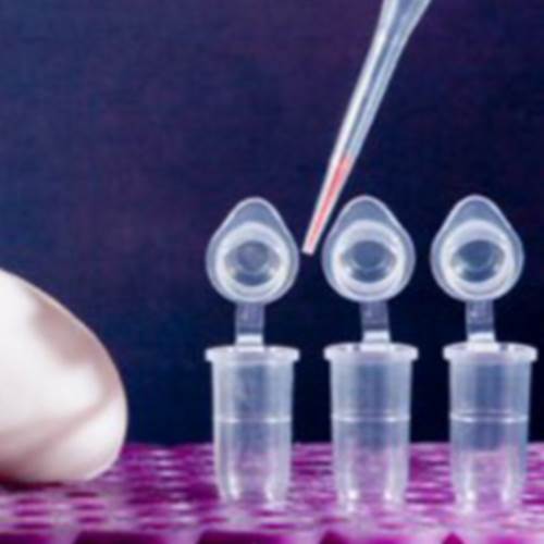 محصول کیت استخراج DNA از شرکت تهران کاوش کلون