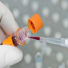 محصول کیت استخراج ویروسی از شرکت تهران کاوش کلون