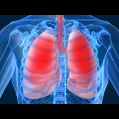محصول ایجاد دانش فنی تولید داروی ماسیتنسان از شرکت هستی آریا شیمی